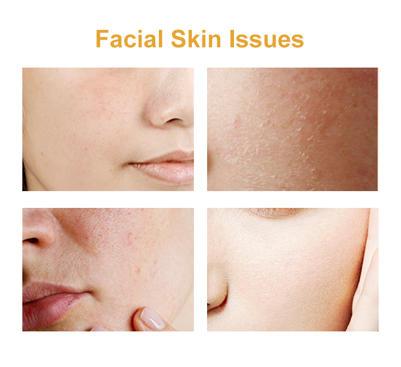 Details of Fullerene Anti-Wrinkle Concentrate Details of Fullerene Anti-Wrinkle Concentrate