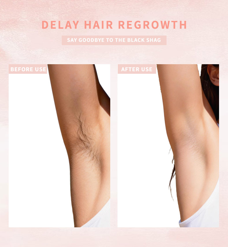 Details of Hair Remover Cream Details of Hair Remover Cream