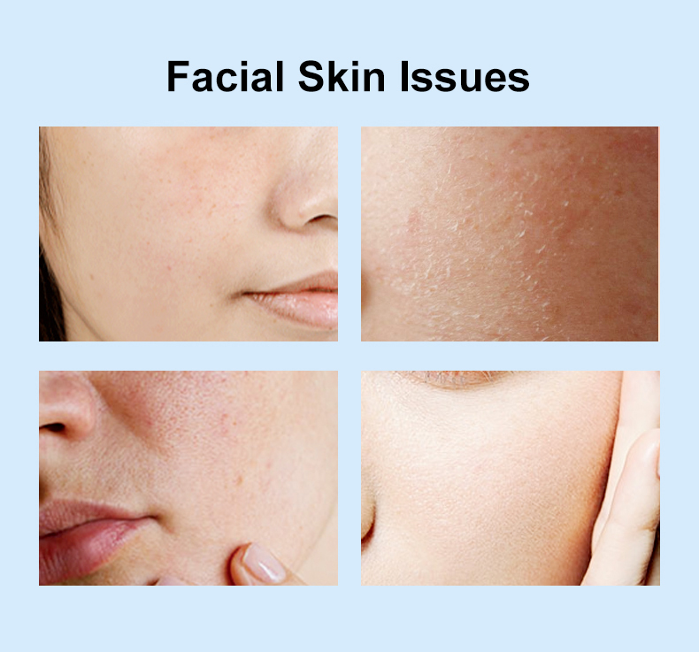 Details of Hyaluronic Moisturizing Capsule Cream