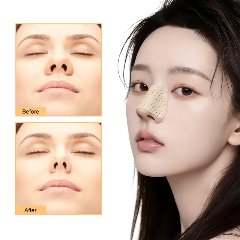 Thermoplastic Nose Splint
