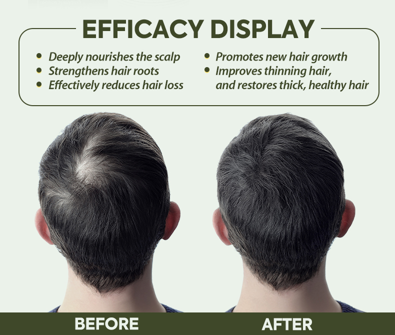 Details of Hair Growth Spray Details of Hair Growth Spray