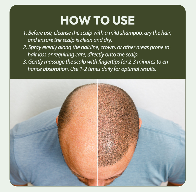 Details of Hair Growth Spray Details of Hair Growth Spray