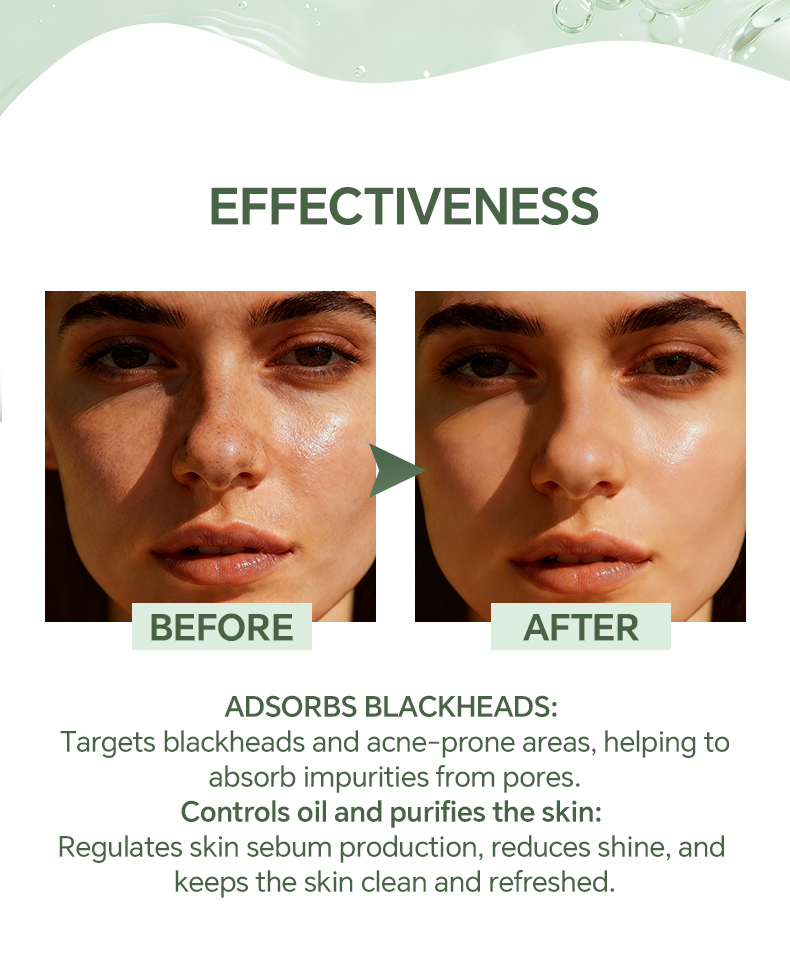 Details of Salicylic Acid Blackhead Removal Mask Cream