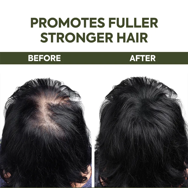 Hair Growth Spray