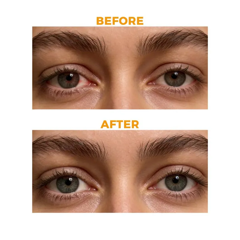 Lutein Eye Protection Spray